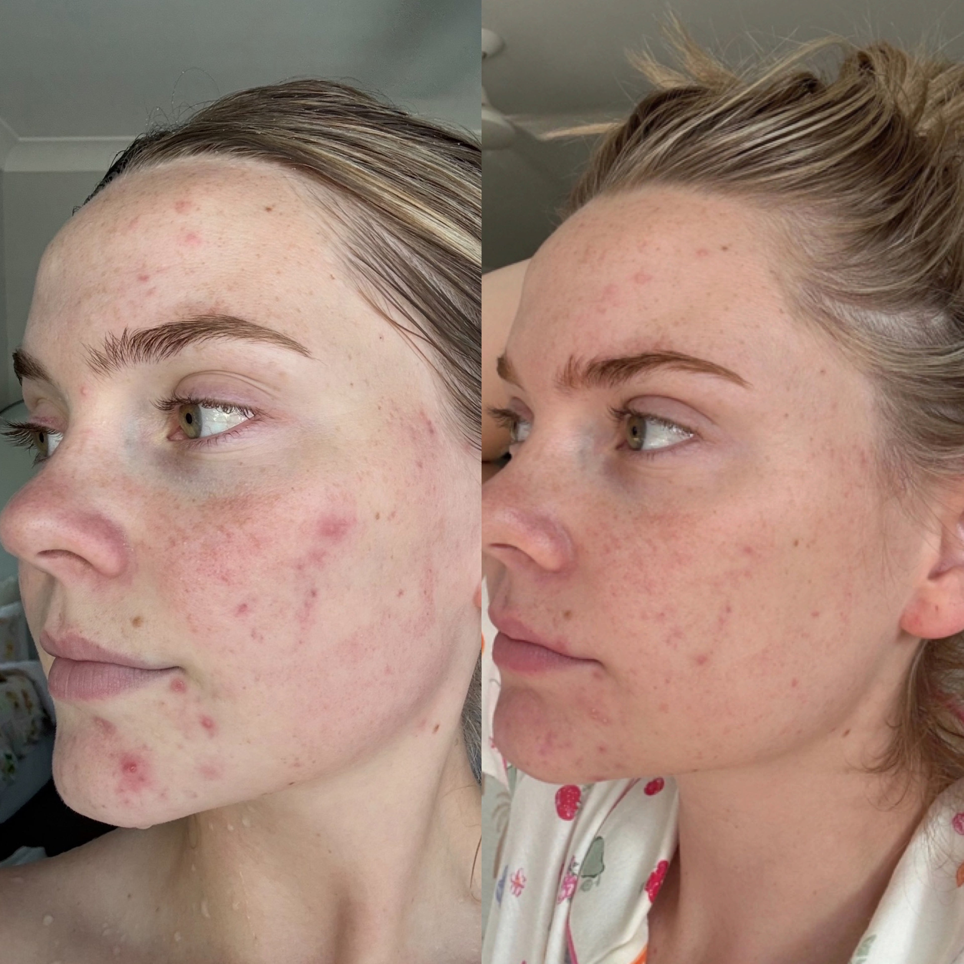 Bye-Bye Blemishes Trio