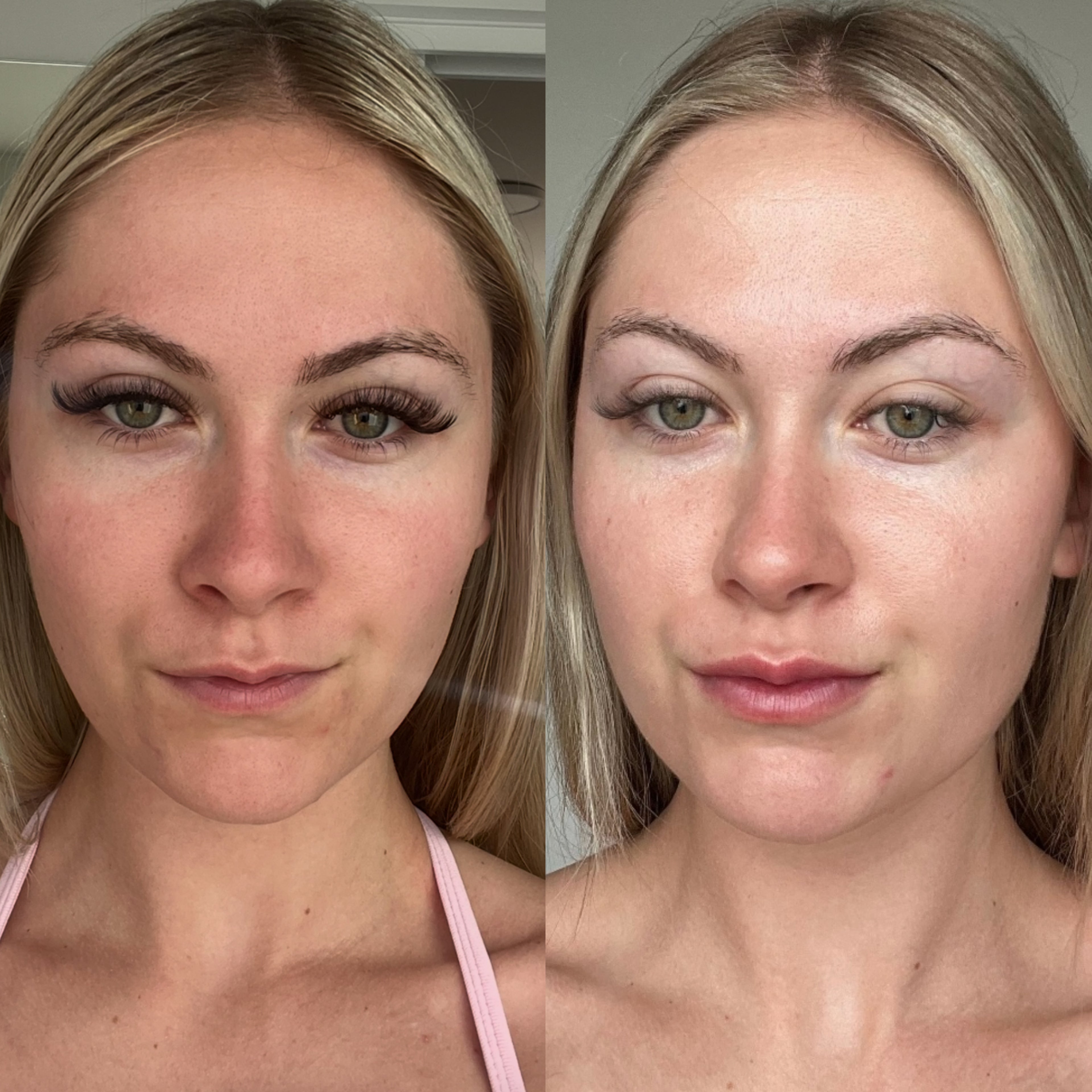 Skin Therapy Serum (Niacinamide)