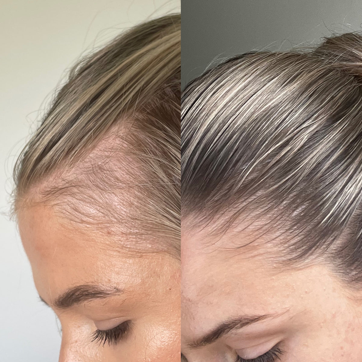 BARE Follicle Revival Hair Growth Oil (Limited Edition)