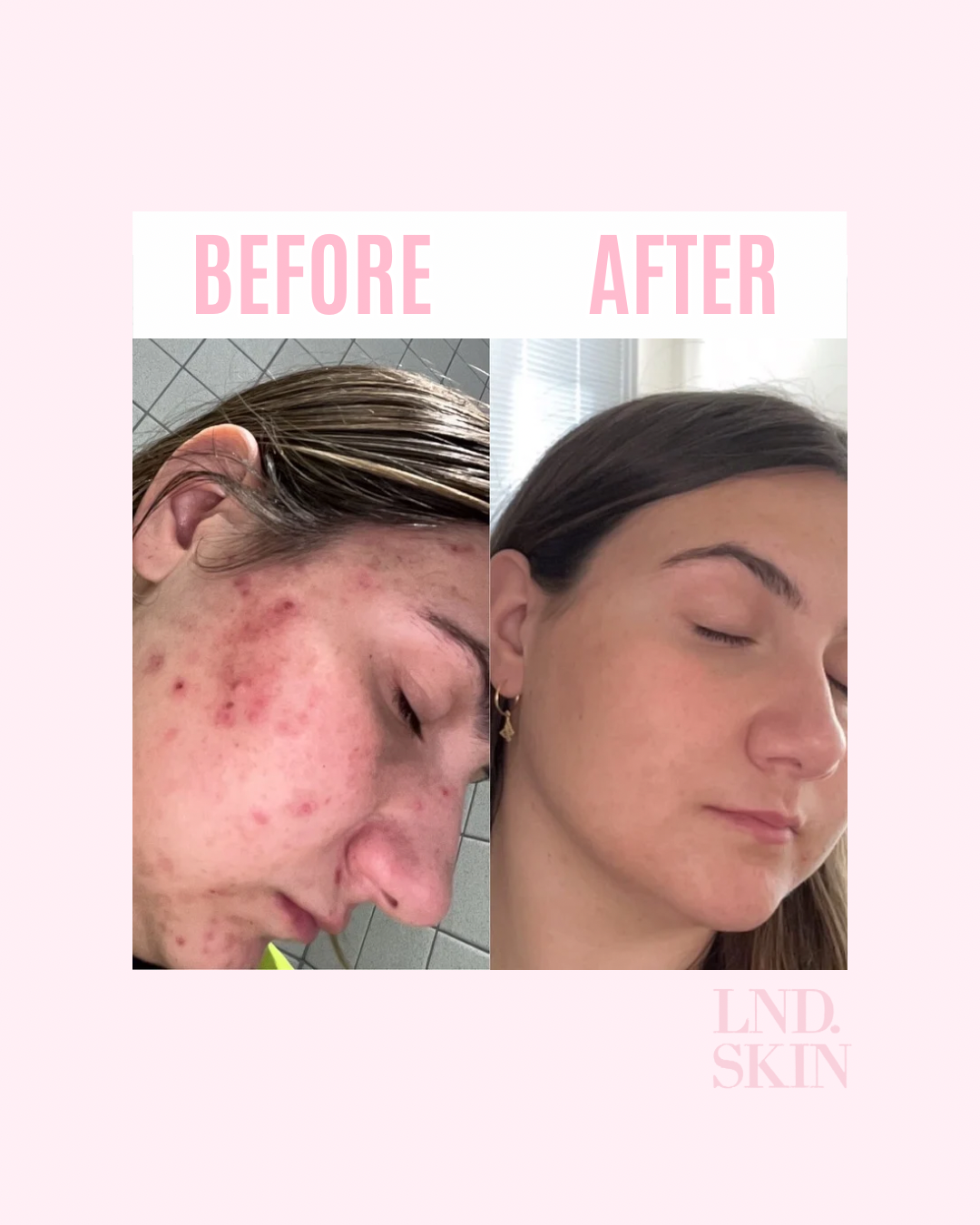 Pretty in Pink Clay Mask