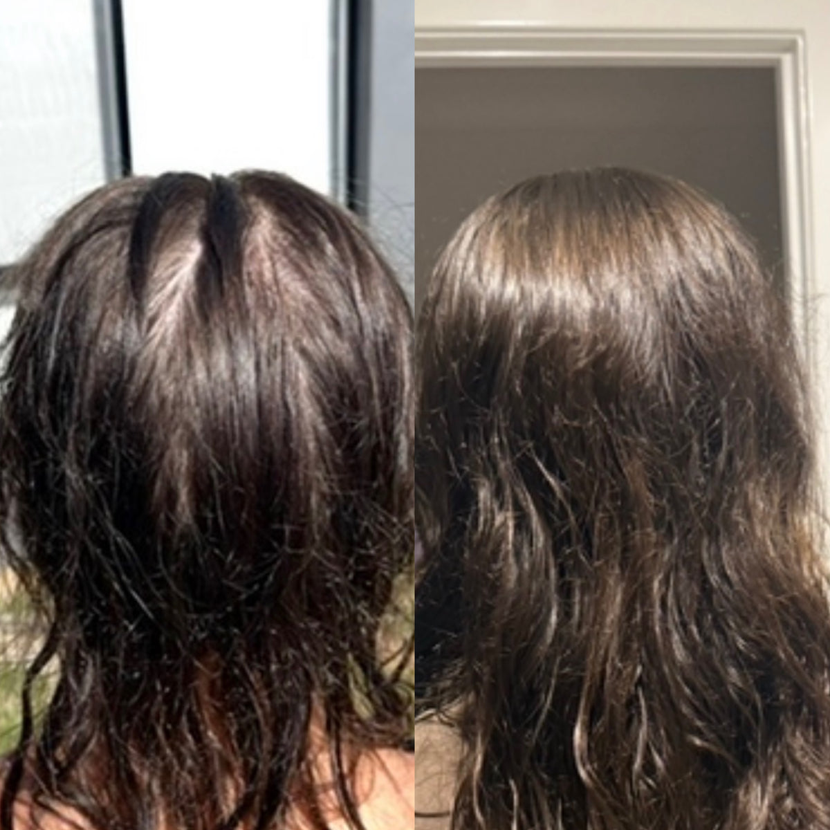 BARE Follicle Revival Hair Growth Oil (Limited Edition)