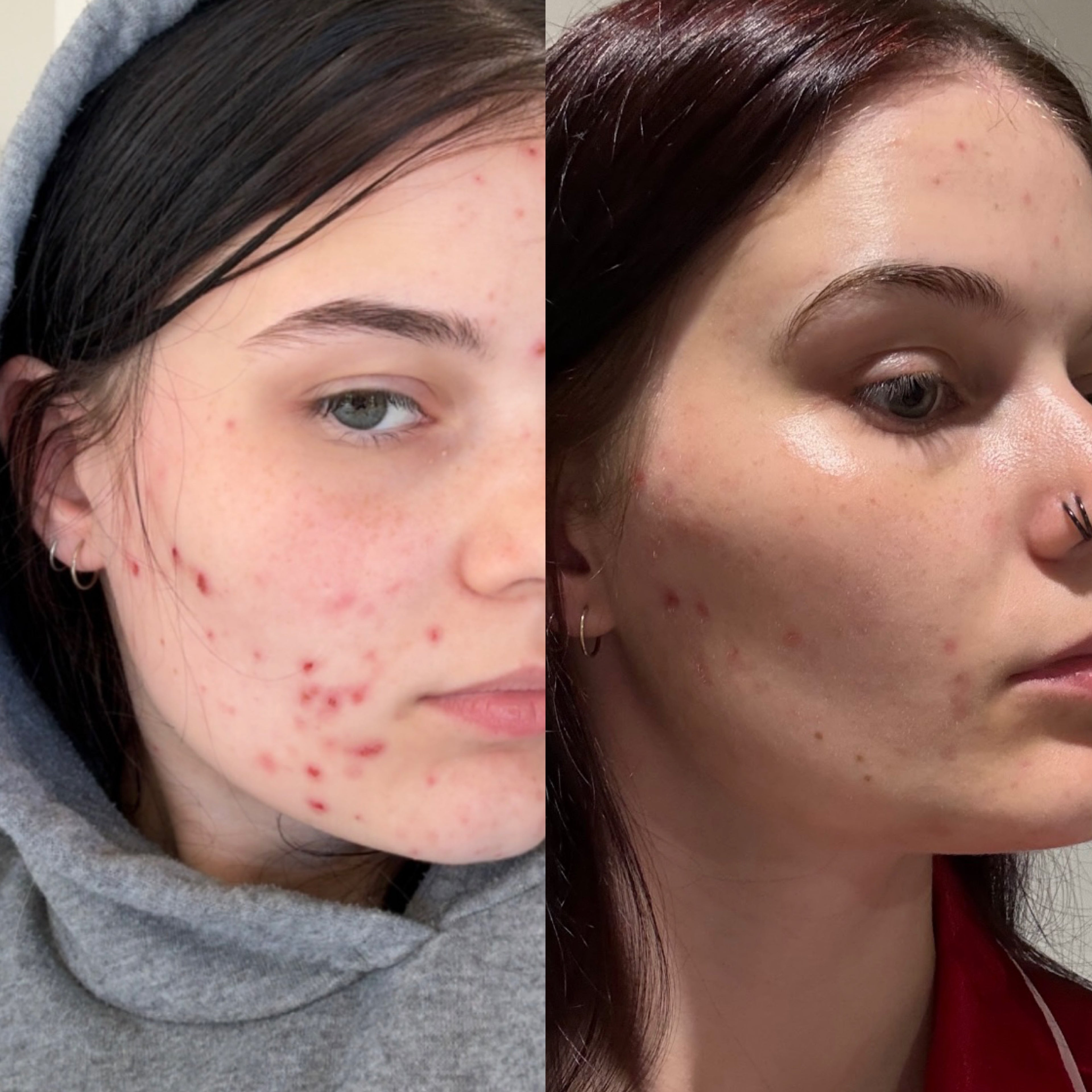 Clarifying Gel Cleanser