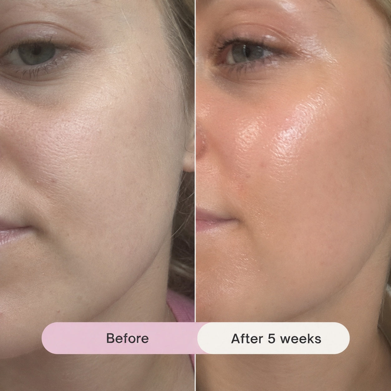 You Glow Girl (Hyaluronic Acid) Serum