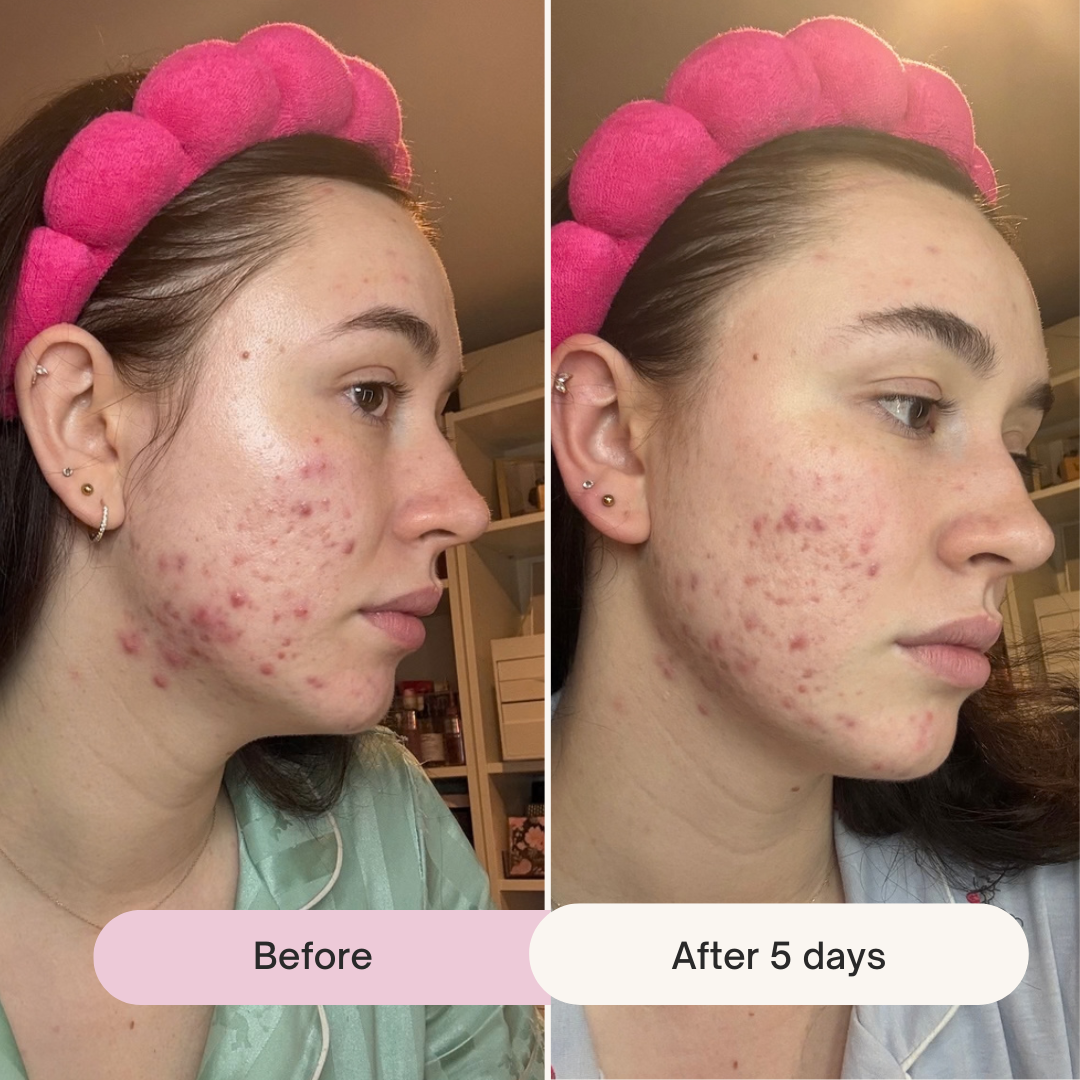 Clarifying Moisturiser